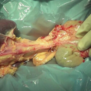 Buy Human Pancreas Online