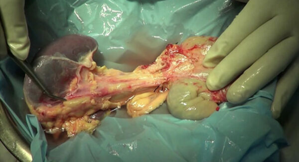 Buy Human Pancreas Online