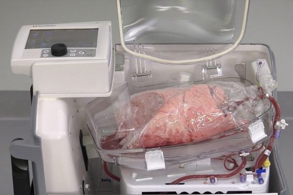 Real Human Lungs For Sale - Image 2