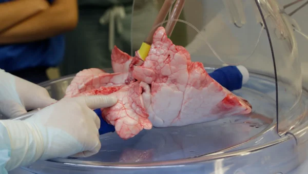 Real Human Lungs For Sale