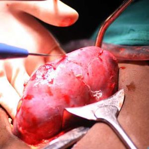 Human Kidney For Sale - Image 2